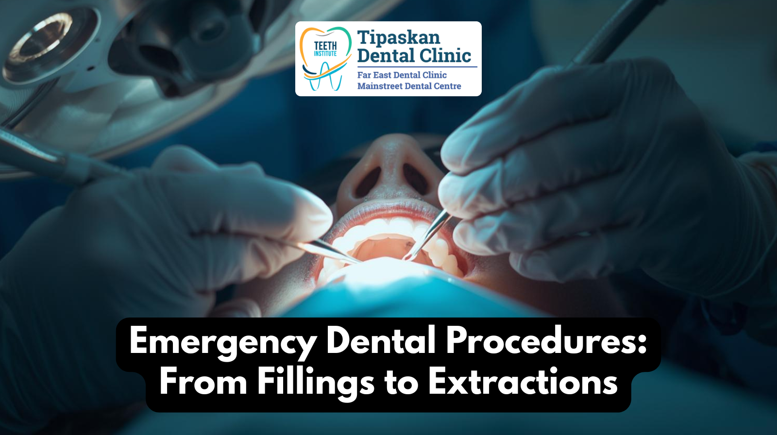 Emergency Dental Procedures From Fillings to Extractions
