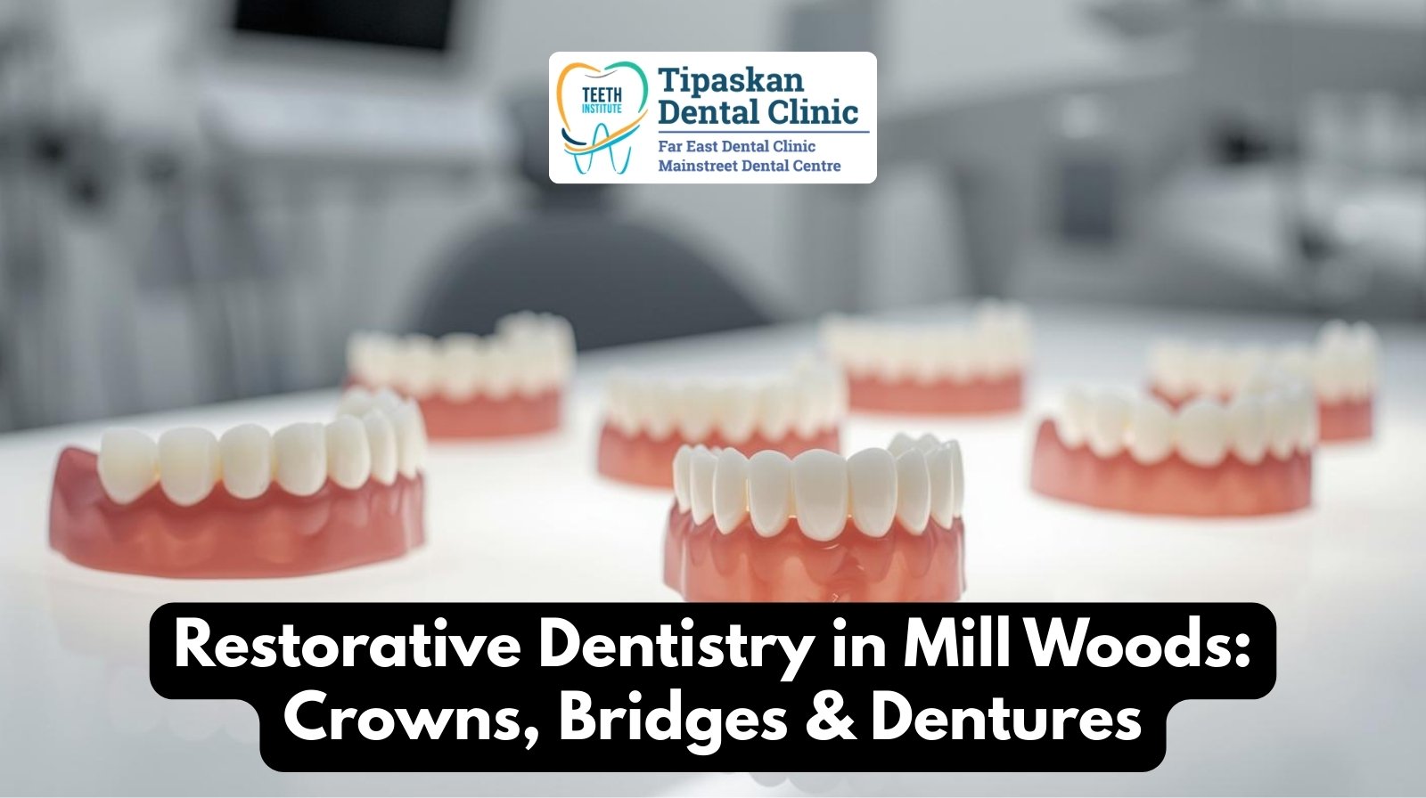 Millwoods Dentistry restorative dentistry – Tipaskan Dental Clinic