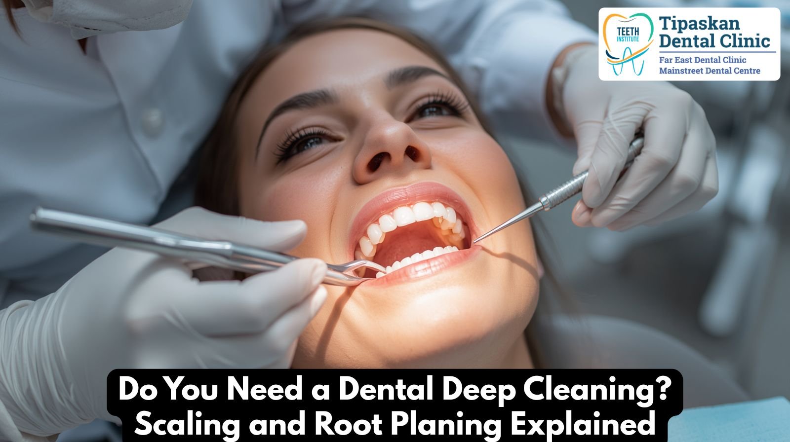 Dental Deep Cleaning