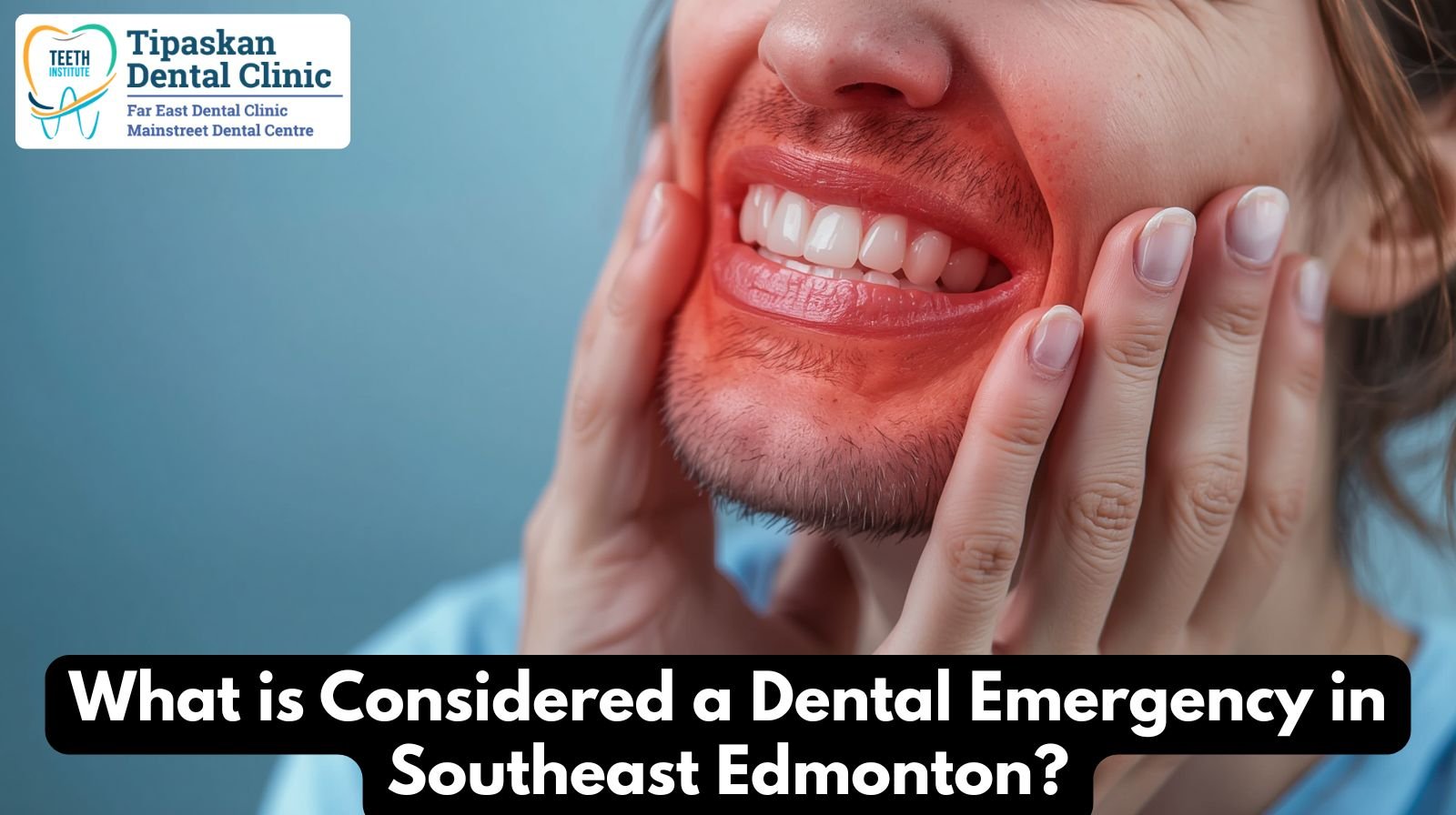 Dental Emergency in Southeast Edmonton